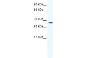 Western Blotting (WB) image for anti-Homeobox B1 (HOXB1) antibody (ABIN2461437) (HOXB1 Antikörper)