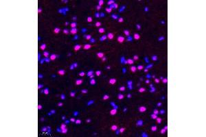 Immunofluorescence of paraffin embedded rat brain using rap1 (ABIN7075857) at dilution of 1: 2000 (400x lens) (RAP1 Antikörper)