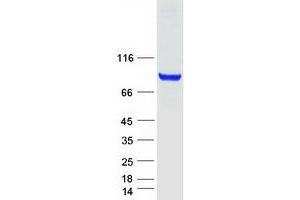 Western Blotting (WB) image for Coagulation Factor XIII, A1 Polypeptide (F13A1) protein (Myc-DYKDDDDK Tag) (ABIN2712929)