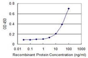 Detection limit for recombinant GST tagged DECR2 is 1 ng/ml as a capture antibody. (DECR2 Antikörper  (AA 49-109))