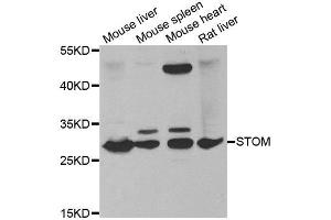 Western blot analysis of extracts of various tissues, using STOM antibody. (Stomatin Antikörper)