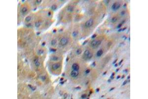 Used in DAB staining on fromalin fixed paraffin-embedded Liver tissue (Clusterin Antikörper  (AA 228-449))