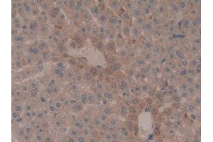 Immunohistochemistry (IHC) image for anti-ATPase, Na+/K+ Transporting, beta 3 Polypeptide (ATP1B3) (AA 66-273) antibody (ABIN7440425)