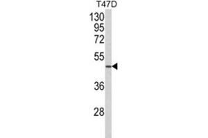 Western Blotting (WB) image for anti-Neutrophil Cytosolic Factor 1C Pseudogene (NCF1C) antibody (ABIN3003869)