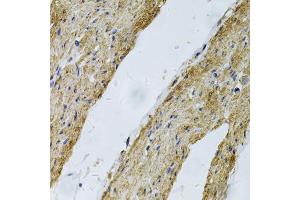 Immunohistochemistry of paraffin-embedded human smooth muscle using VCL Antibody (ABIN5970881) at dilution of 1/100 (40x lens). (Vinculin Antikörper)