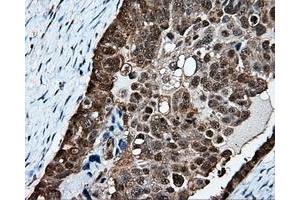 Immunohistochemical staining of paraffin-embedded Kidney tissue using anti-PSMC3 mouse monoclonal antibody. (PSMC3 Antikörper)