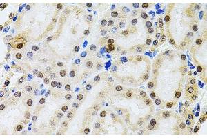 Immunohistochemistry of paraffin-embedded Rat kidney using POP4 Polyclonal Antibody at dilution of 1:100 (40x lens).