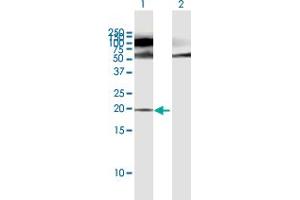 Western Blot analysis of POMP expression in transfected 293T cell line by POMP MaxPab polyclonal antibody. (POMP Antikörper  (AA 1-141))