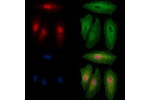 Phospho-PPAR gamma (Ser273) Antibody staining A549 cells(heat shock treatment) by IF/ICC. (PPARG Antikörper  (pSer273))