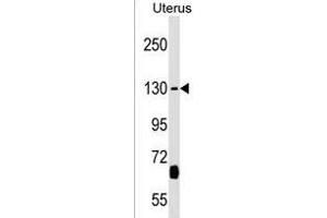 KIF27 Antibody (C-term) (ABIN1536712 and ABIN2838099) western blot analysis in Uterus tissue lysates (35 μg/lane). (KIF27 Antikörper  (C-Term))