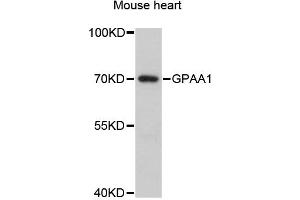 Western blot analysis of extracts of mouse heart, using GPAA1 antibody (ABIN6292961) at 1:3000 dilution. (GPAA1 Antikörper)