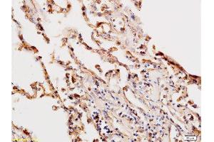 Formalin-fixed and paraffin embedded human lung labeled with Anti-Beta-HCG/HCG beta Polyclonal Antibody, Unconjugated  at 1:200, followed by conjugation to the secondary antibody and DAB staining