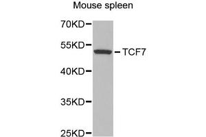 Western blot analysis of extracts of mouse spleen, using TCF7 antibody (ABIN1875040) at 1:300 dilution. (TCF7 Antikörper)