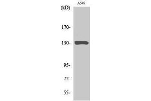 Western Blotting (WB) image for anti-Janus Kinase 1 (JAK1) (Ser639) antibody (ABIN3175726) (JAK1 Antikörper  (Ser639))