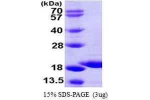 GSK3B interacting protein (GSKIP) (AA 1-139) protein (His tag)