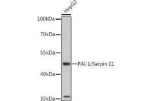 Western blot analysis of extracts of Rat placenta, using PAI-1/Serpin E1 antibody (ABIN6131330, ABIN6147601, ABIN6147603 and ABIN6221802) at 1:1000 dilution. (PAI1 Antikörper  (AA 24-402))