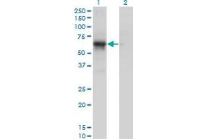 Western Blot analysis of PCTK1 expression in transfected 293T cell line by PCTK1 monoclonal antibody (M01), clone 4D2.
