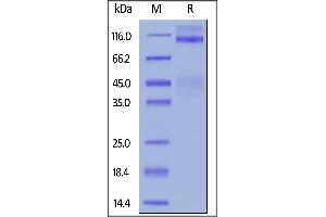 Cynomolgus IGF-I R, His Tag on  under reducing (R) condition. (IGF1R Protein (AA 31-932) (His tag))