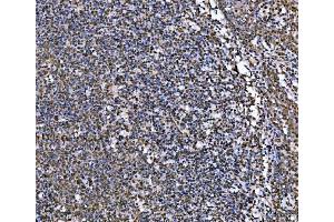 IHC analysis of MRE11 using anti-MRE11 antibody (ABIN7601056).