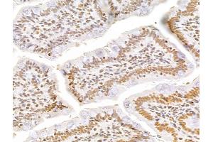 ABIN7094256 and ABIN7098303 at 1/100 staining Rat colon tissue by IHC-P.