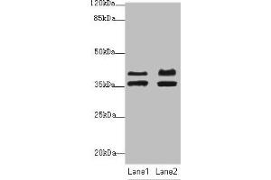 Western blot All lanes: IKBIPantibody at 2. (IKbIP Antikörper  (AA 121-350))