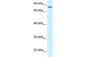 WB Suggested Anti-PPP6R3 Antibody Titration: 1. (PPP6R3 Antikörper  (C-Term))