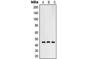 Western blot analysis of RNF130 expression in SKMEL28 (A), HuvEc (B), HeLa (C) whole cell lysates.