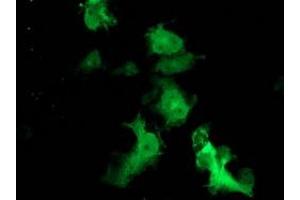 Anti-FBXO21 mouse monoclonal antibody (ABIN2455369) immunofluorescent staining of COS7 cells transiently transfected by pCMV6-ENTRY FBXO21 (RC223095). (FBXO21 Antikörper)