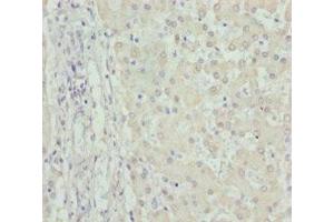 Immunohistochemistry of paraffin-embedded human liver tissue using ABIN7149965 at dilution of 1:100 (FMO5 Antikörper  (AA 1-285))