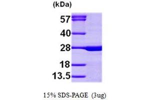 CHP Protein (AA 1-195) (His tag)