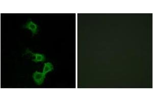 Immunofluorescence analysis of MCF7 cells, using Dab1 (Ab-232) Antibody. (DAB1 Antikörper  (AA 199-248))
