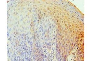 Immunohistochemistry of paraffin-embedded human tonsil tissue using ABIN7173838 at dilution of 1:100 (TNFRSF1D (AA 257-386) Antikörper)