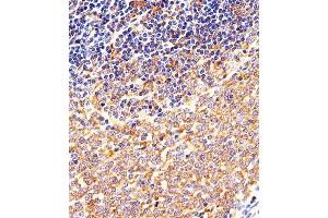 Immunohistochemical analysis of paraffin-embedded M. (CSK Antikörper  (N-Term))