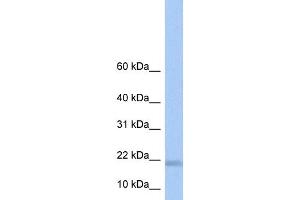WB Suggested Anti-LOC284009 Antibody Titration: 0.