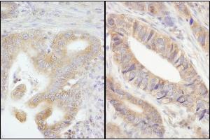 Immunohistochemistry (IHC) image for anti-Protein Tyrosine Phosphatase G1 (PTPN12) (AA 760-780) antibody (ABIN7453765) (PTPN12 Antikörper  (AA 760-780))
