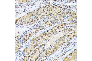 Immunohistochemistry of paraffin-embedded rat ovary using FKBP51/FKBP5 Rabbit mAb (ABIN7267213) at dilution of 1:100 (40x lens). (FKBP5 Antikörper)