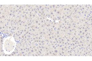 Detection of ADH1 in Mouse Liver Tissue using Polyclonal Antibody to Alcohol Dehydrogenase 1 (ADH1) (ADH1 Antikörper  (AA 25-228))