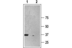 Western blot analysis of rat brain membranes: 1. (Purinergic Receptor P2X, Ligand-Gated Ion Channel, 6 (P2RX6) Peptid)