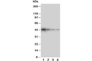 Western blot testing of DDR1 antibody and Lane 1:  recombinant human protein 10ng;  2: 5ng;  3: 2. (DDR1 Antikörper  (C-Term))