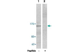 Western blot analysis of extracts from HeLa cells, using COL4A1 polyclonal antibody . (COL4A1 Antikörper  (AA 31-70))