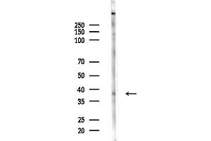 anti-Integrin beta 1 Binding Protein (Melusin) 2 (ITGB1BP2) (N-Term) antibody