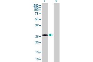 Western Blotting (WB) image for anti-Achalasia, Adrenocortical Insufficiency, Alacrimia (AAAS) (AA 1-546) antibody (ABIN521759)