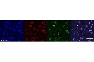 Immunohistochemistry (IHC) image for anti-Oligodendrocytic Myelin Paranodal and Inner Loop Protein (OPALIN) antibody (ABIN7456142) (OPALIN Antikörper)