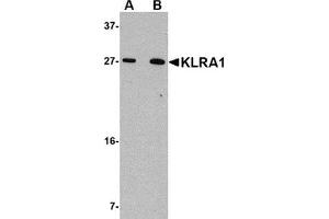 Western blot analysis of KLRA1 in 293 cell lysate with KLRA1 antibody at (A) 1 μg/ml and (B) 2 μg/ml. (KLRA1 Antikörper  (C-Term))