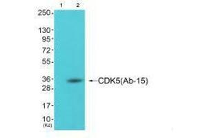 Western blot analysis of extracts from cos-7 cells (Lane 2), using CDK5 (Ab-15) antiobdy. (CDK5 Antikörper  (Tyr15))