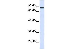 DDX1 antibody used at 1 ug/ml to detect target protein. (DDX1 Antikörper)