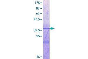 Image no. 1 for Intercellular Adhesion Molecule 5 (ICAM5) (AA 34-131) protein (GST tag) (ABIN1307331) (ICAM5 Protein (AA 34-131) (GST tag))