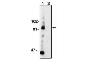 Image no. 1 for anti-ADAM Metallopeptidase Domain 10 (ADAM10) (AA 732-748) antibody (ABIN264988) (ADAM10 Antikörper  (AA 732-748))