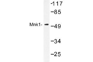Image no. 1 for anti-MAP Kinase Interacting serine/threonine Kinase 1 (MKNK1) antibody (ABIN272252) (MKNK1 Antikörper)