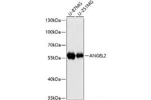 Western blot analysis of extracts of various cell lines using ANGEL2 Polyclonal Antibody at dilution of 1:3000. (ANGEL2 Antikörper)